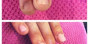 Histoire d'Ongles La rochelle - Prothésite ongulaire - Vernis Semi-permanent - Pose d'ongles en gel - Pose de faux ongles