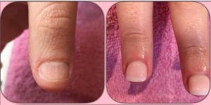 Histoire d'Ongles La rochelle - Prothésite ongulaire - Vernis Semi-permanent - Pose d'ongles en gel - Pose de faux ongles