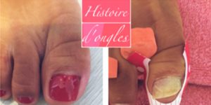 Histoire d'Ongles La rochelle - Prothésite ongulaire - Vernis Semi-permanent - Pose d'ongles en gel - Pose de faux ongles